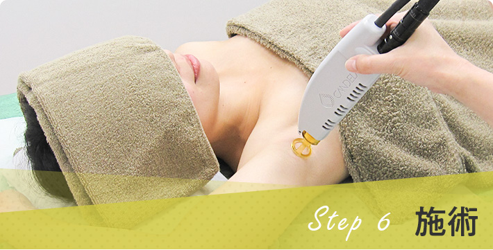 step6 施術