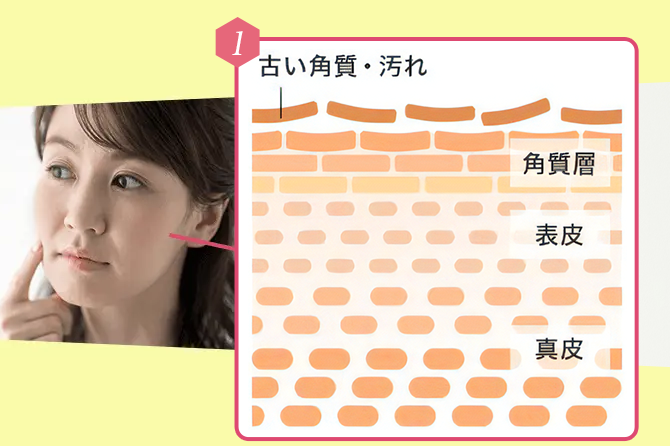 古い角質や汚れがニキビ・毛穴目立ちの原因