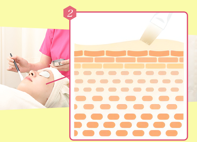 ピーリングで古い角質や毛穴汚れを除去