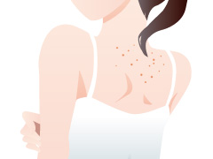 医療レーザー脱毛によって起きうる毛嚢炎は、というニキビに似た症状です。