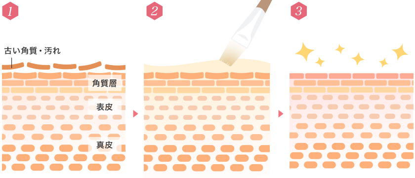 ピーリング ケミカル 勘違いしてたかも…ケミカルピーリングはしわシミたるみのどれに効く？