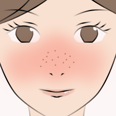 町田マリアクリニックの毛穴・赤ら顔治療